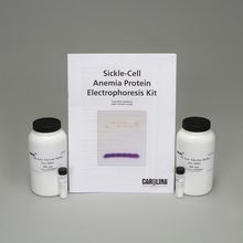 Sickle Cell Anemia Protein Electrophoresis Kit