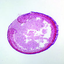 Frog Yolk Plug