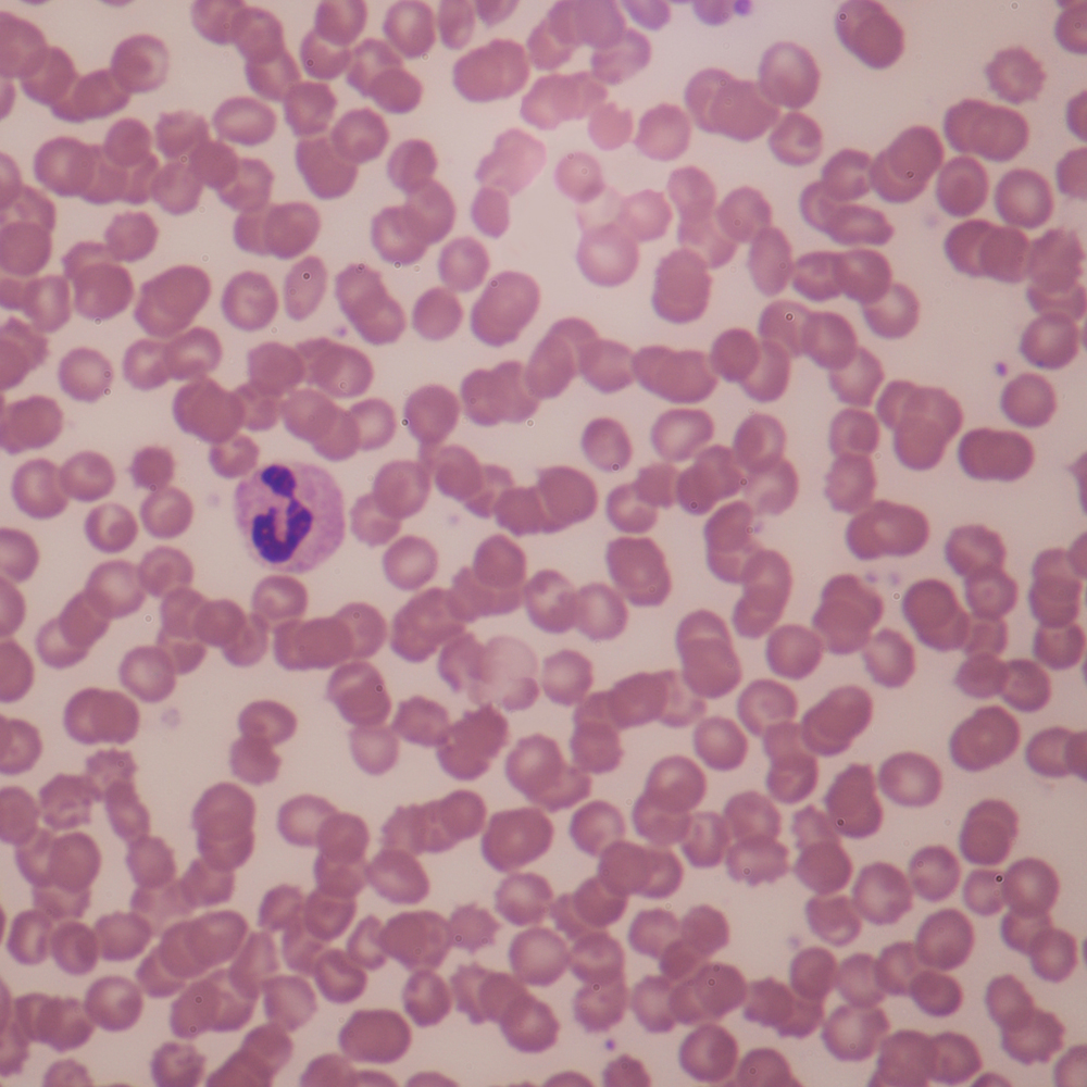 Peripheral Blood Film Male, smear Microscope Slide