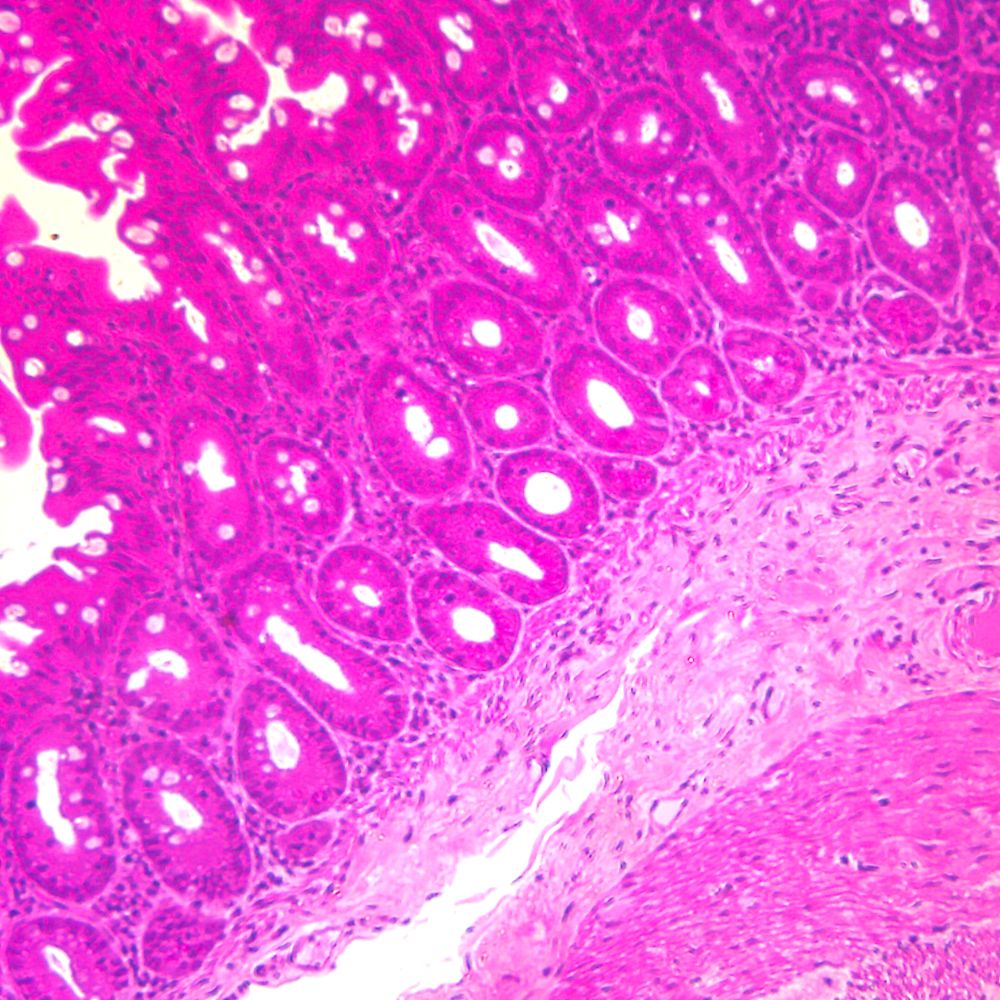 List 93+ Pictures What Type Of Tissue Is Simple Columnar Tissue Sharp