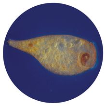 Stentor coeruleus, Living | Carolina Biological Supply