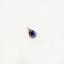 Giardia lamblia Trophozoites Slide, Smear, HH | Carolina
