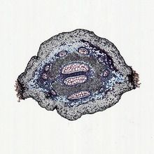 Pteridium Rhizome, c.s., 12 µm Microscope Slide | Carolina