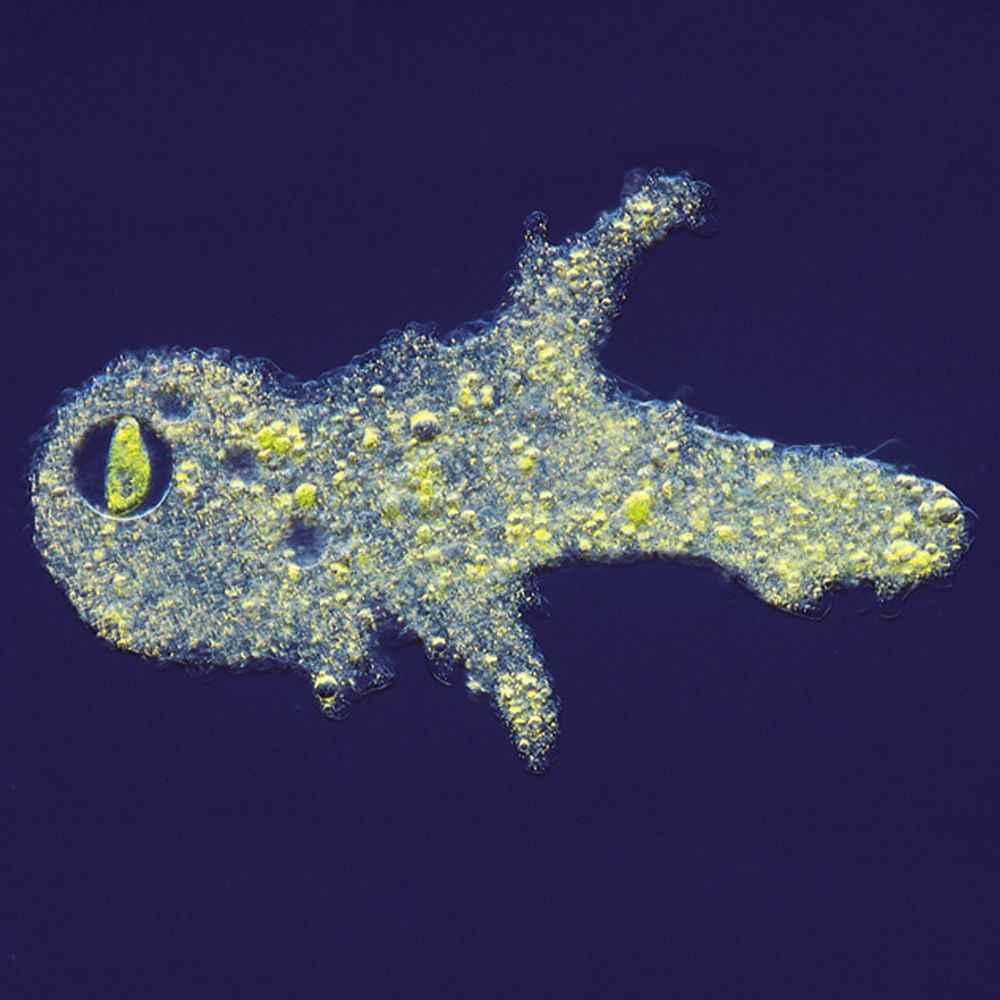 protista amoeba