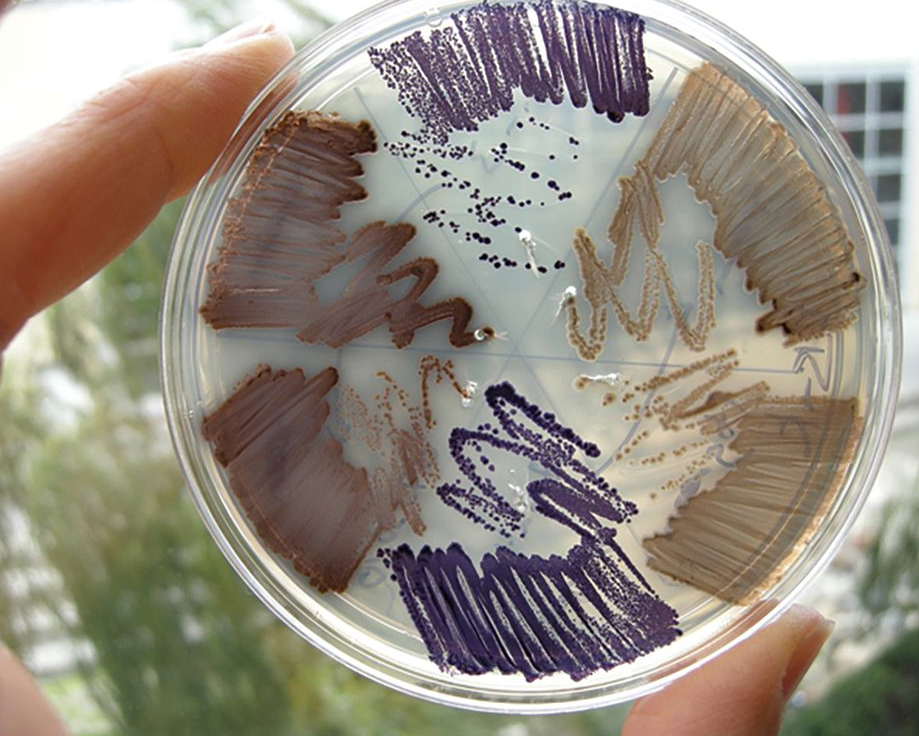bacterial transformation and chassis selection.