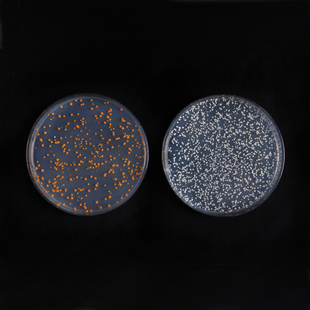 bacterial transformation