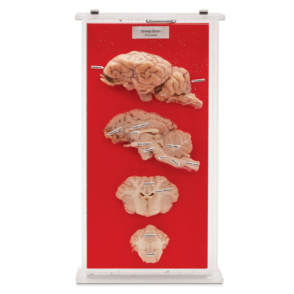 Arbor Vitae Sheep Brain