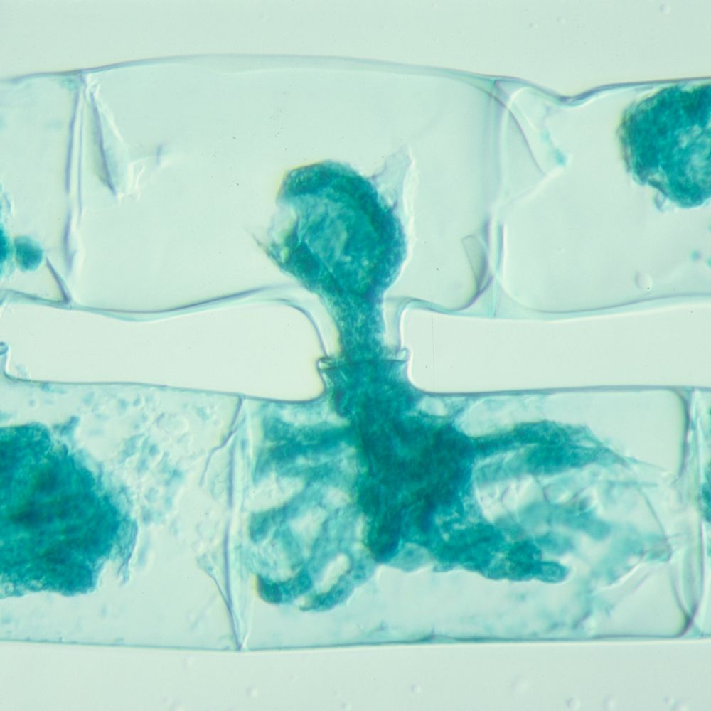 Spirogyra Scalariform Conjugation, All Stages, w.m. Microscope Slide