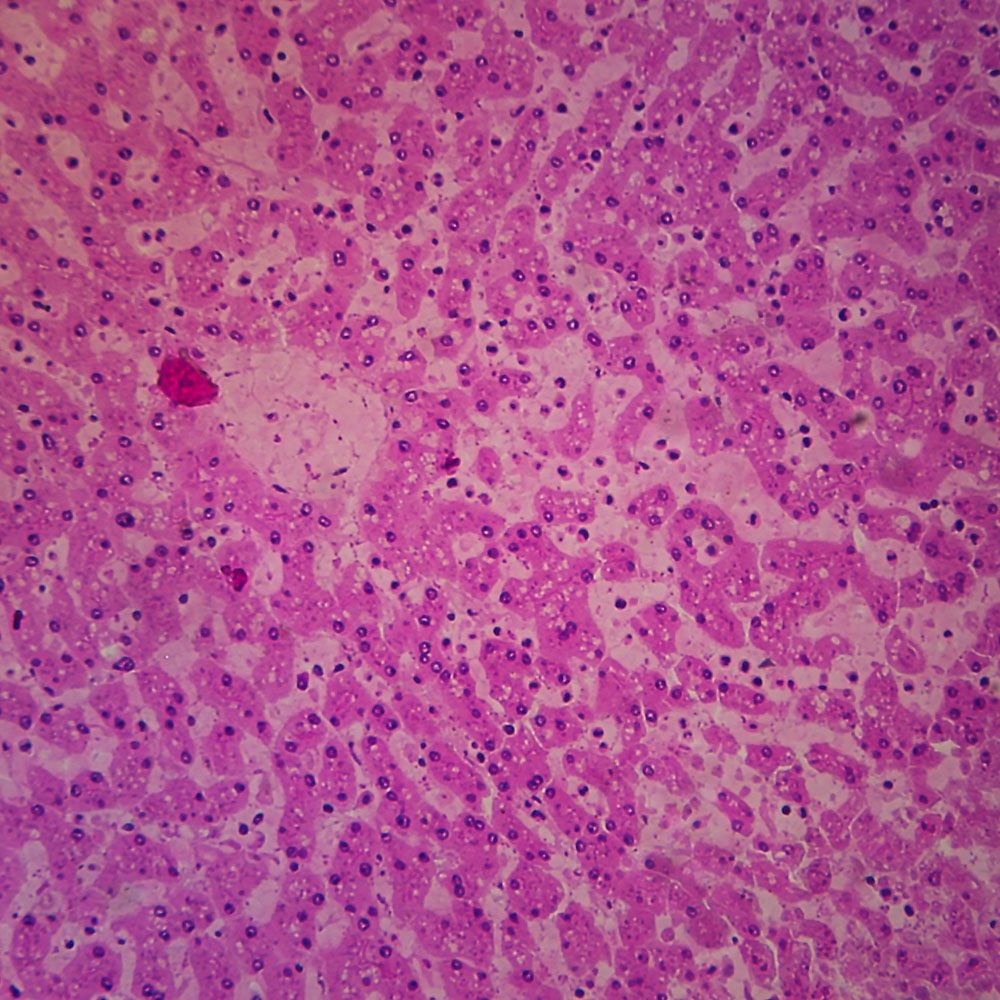 liver slide