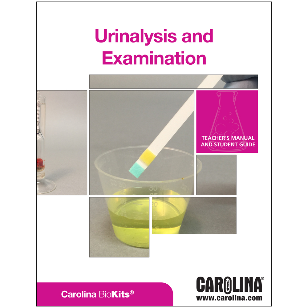 Urinalysis and Examination Digital Resources Carolina Biological Supply