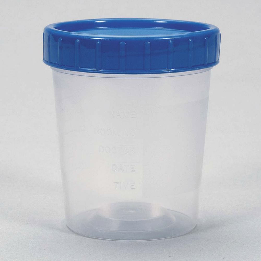 Sterile Specimen Cups