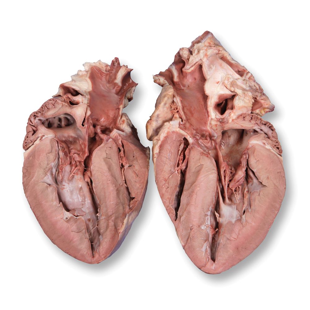 "Carolina's Perfect Solution&reg; Preserved Pig Hearts, Plain"
