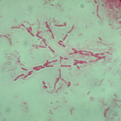 Bacillus Subtilis Living Plate 1