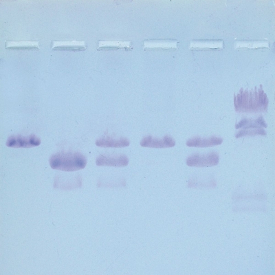 Natures Dice A Genetic Screening Simulation Autosomal Recessive Trait Classroom Kit With Voucher 1