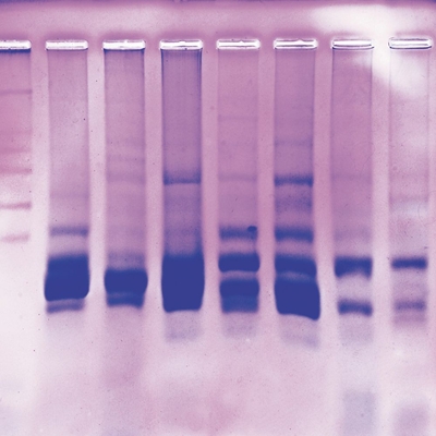 Fish Protein Fingerprinting On Agarose Gels Perishables Refill Kit A