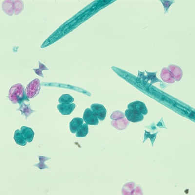 Mixed Desmids Wm Microscope Slide 1