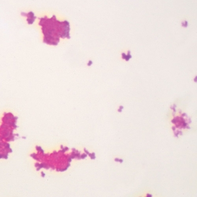 Neisseria Gonorrhoeae Wm Microscope Slide