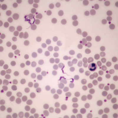 Trypanosoma Cruzi In Blood Smear Microscope Slide