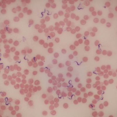 Trypanosoma Rhodesiense Smear Microscope Slide