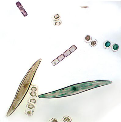 Freshwater And Marine Diatoms Slide Wm