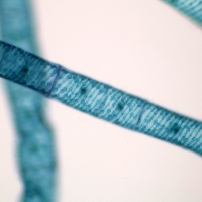 Spirogyra With Multiple Chloroplasts Slide Wm