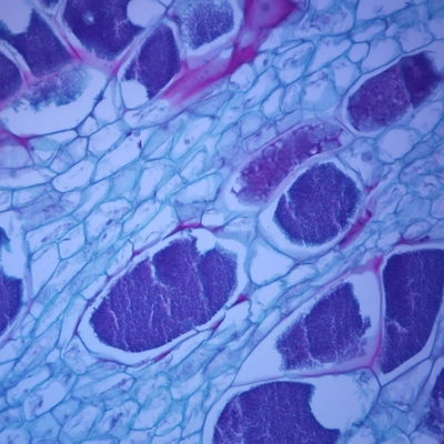 Cabbage Clubroot Sec 12 Um Microscope Slide