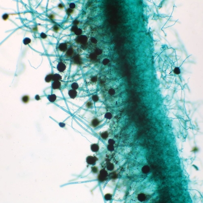 Aspergillus Conidiophores Slide W M