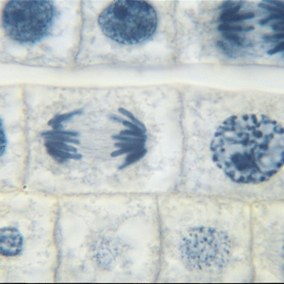 Onion Mitosis Slide Ls 10 M Hematoxylin 1