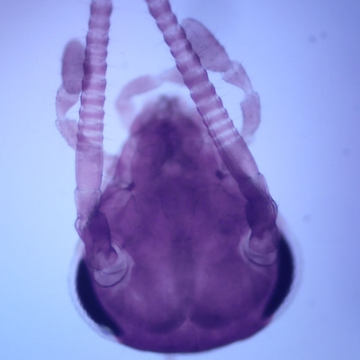 Cockroach Head Wm Microscope Slide