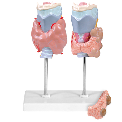 Altay® Pathology of the Human Thyroid Model | Carolina Biological Supply
