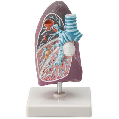 Altay Pathology Of The Human Lung Model