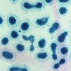 Microcystis, Living