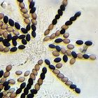 Sordaria Fimicola Fungi Cultures