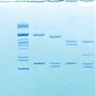 Restriction Mapping Of Plasmid Dna Kit