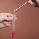 Strawberry Milkshakes: DNA and Lactose Intolerance