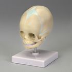 Altay Fetal Skull