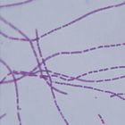 Bacillus Anthracis Microscope Slides