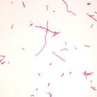Typical Spirillum Bacteria Microscope Slides, w.m.