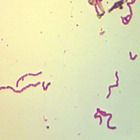 Helicobacter Pylori Wm Individual Microscope Slide