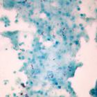 Mycobacterium Tuberculosis Wm Microscope Slide