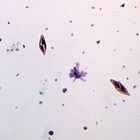 Mixed Protists Microscope Slides (mixed protozoa, dinoflagellates), w.m.