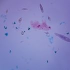 Mixed Protists, w.m. Microscope Slide