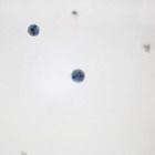 Entamoeba histolytica, Smear Microscope Slides