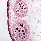 Fucus Monoecious Conceptacle Microscope Slide sec., 12 &#181;m