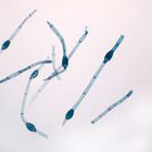 Oedogonium Macrandrous, w.m. Microscope Slide