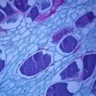 Cabbage Clubroot, sec., 12 &#181;m Microscope Slide