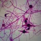 Rhizopus (Zygomycetes) Microscope Slides