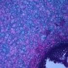 Claviceps purpurea Mature Sclerotium, c.s., 12 &#181;m Microscope Slide