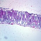 Lilac Mildew, section Microsphaera, Microscope Slide