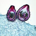 Sordaria fimicola, l.s., 12 &#181;m Microscope Slide